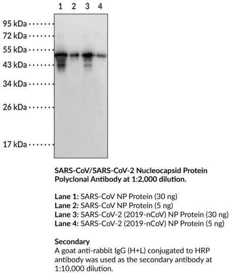 Anti-SARS-CoV/SARS-CoV-2 Nucleocapsid Protein