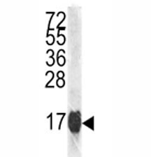 Anti-Histone H3.1