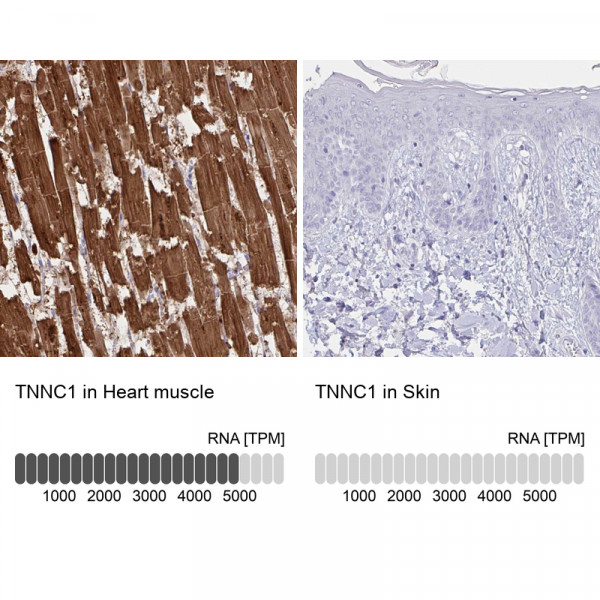 Anti-TNNC1
