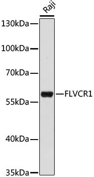 Anti-FLVCR1