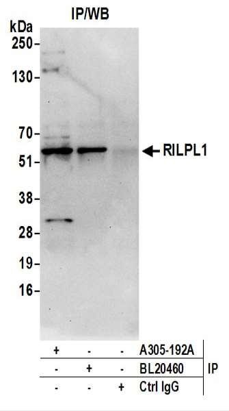 Anti-RILPL1