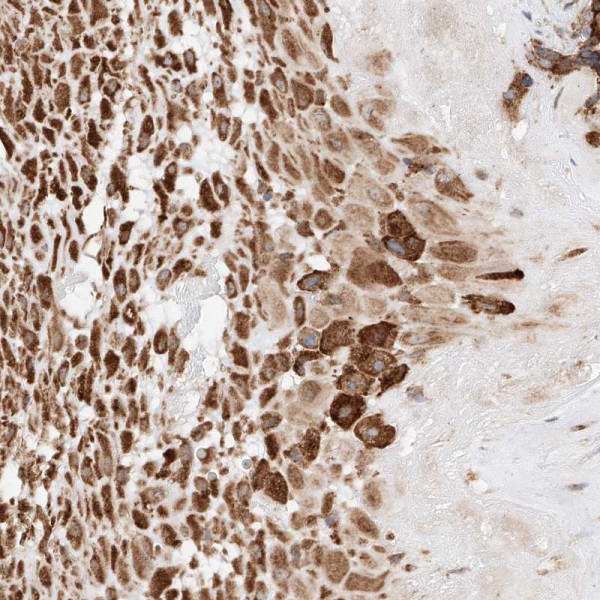 Anti-ATP9B