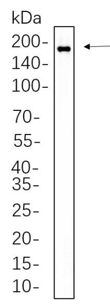 Anti-Recombinant Phospho-HER2 (Tyr1221, 1222), clone 1F12