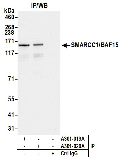 Anti-SMARCC1/BAF155