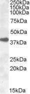Anti-ERCC1, N-terminal