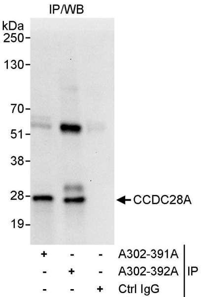 Anti-CCDC28A