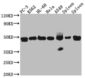 Anti-ACTR3 Recombinant Monoclonal, clone 7E5