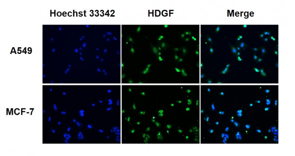 Anti-HDGF, clone SQab1746