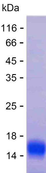 Recombinant Human CYB5R3 Protein