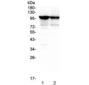 Anti-ACTN3 / Alpha Actinin 3, clone 9B5