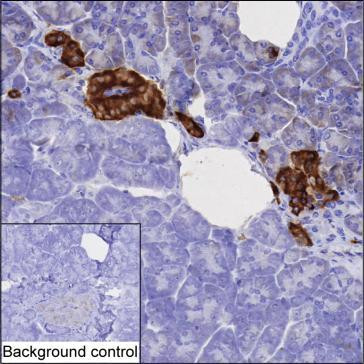 Anti-PCSK1