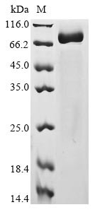 Spike glycoprotein (S), partial, human coronavirus NL63, recombinant