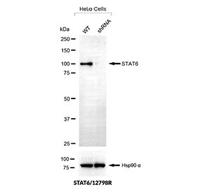Anti-STAT6 / Signal transducer and activator of transcription 6, clone STAT6/12798R