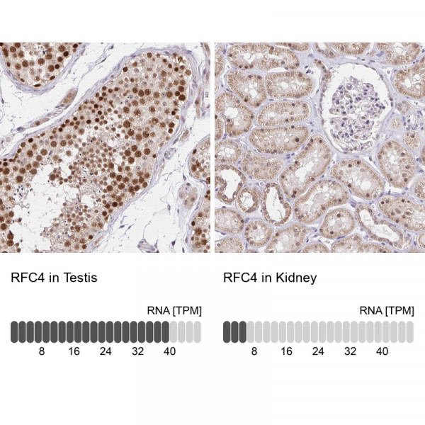 Anti-RFC4