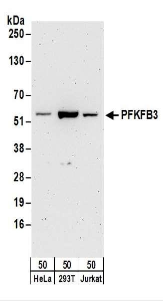 Anti-PFKFB3