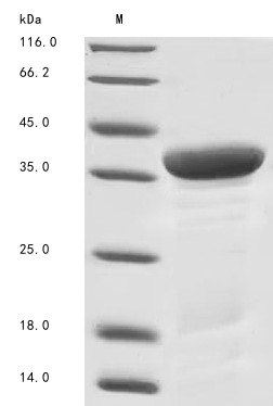 14-3-3 protein zeta/delta (YWHAZ), partial, human, recombinant