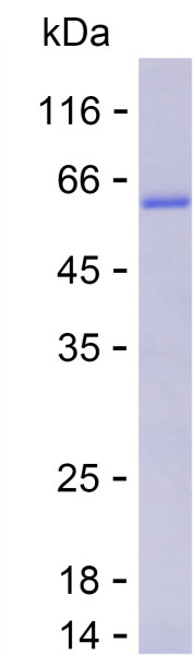 Recombinant Human SLC27A2 Protein