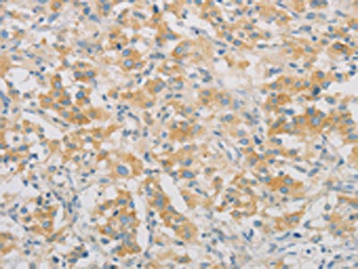 Anti-SPTLC1