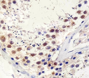 Anti-TBP (TATA Binding Protein), clone 830CT4.3.3