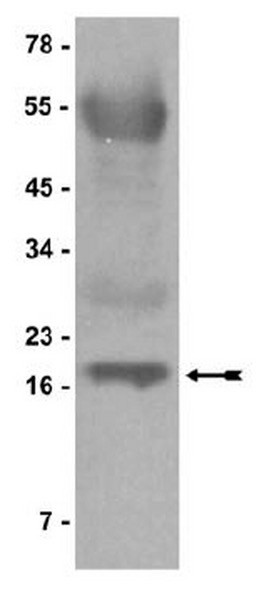 DNA, Salmon Testes, Protein G (Agarose)