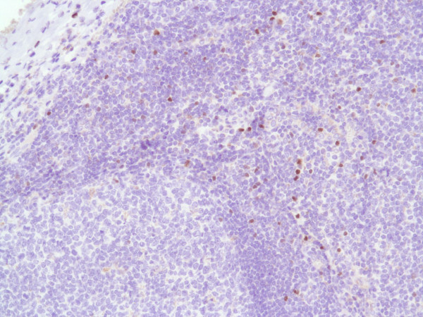 Anti-FOXP3, clone SP97