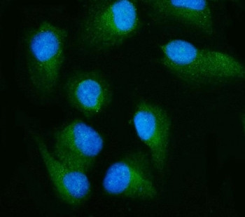 Anti-RALBP1 / RLIP1