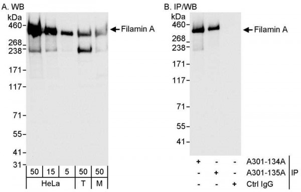 Anti-Filamin A