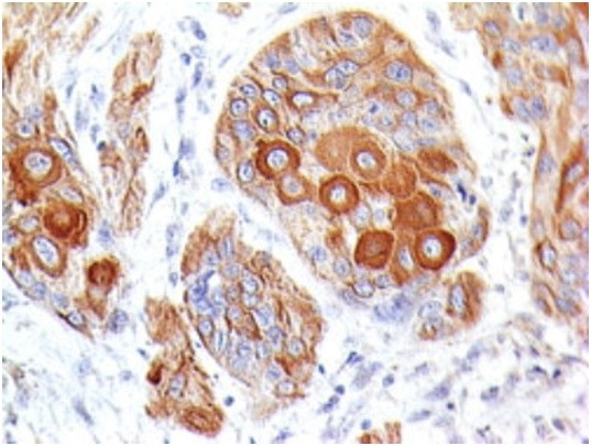 Anti-CD86 (Dendritic Cells Maturation Marker), clone BU63