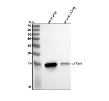 Anti-LYRM4 / LYR motif-containing protein 4