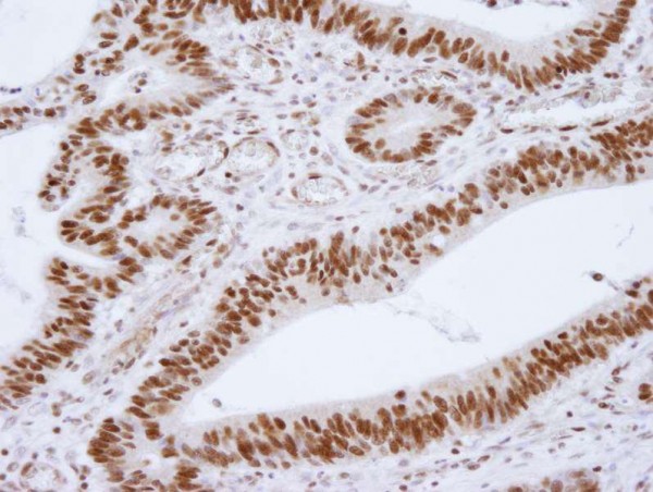 Anti-HDAC1 (IHC)
