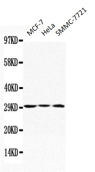 Anti-Apolipoprotein D