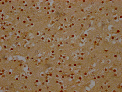 Anti-DDX6 Recombinant Monoclonal, clone 6D8