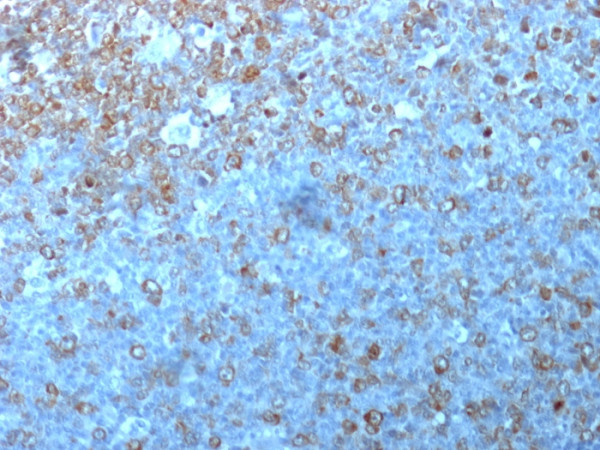 Anti-Cdk1 / p34cdc2, clone POH-1, same as cdc2.1