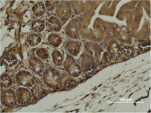 Anti-ACTA2 Monoclonal