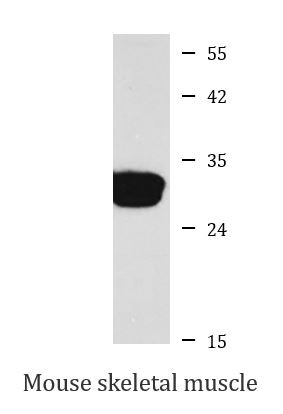 Anti-SULT2A1