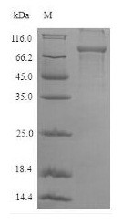 Plastin-2 (LCP1), human, recombinant