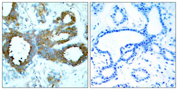 Anti-phospho-PAK1 / PAK2 / PAK3 (Thr423/Thr402/Thr421)