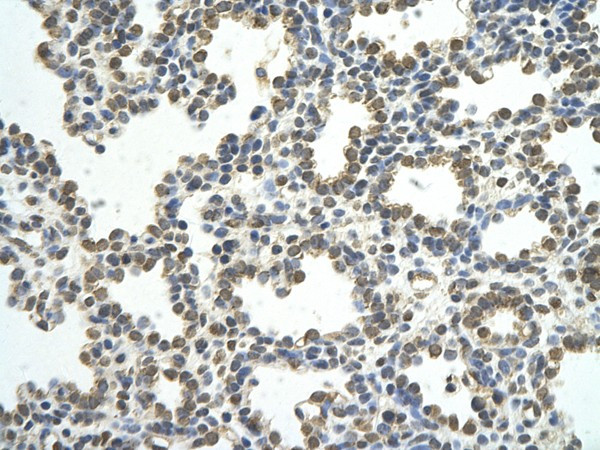 Anti-CSTF2 / CstF 64