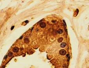 Anti-Torsin 1A