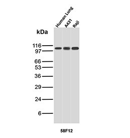 Anti-HSPH1 / Heat shock protein 105 kDa, clone r58F12