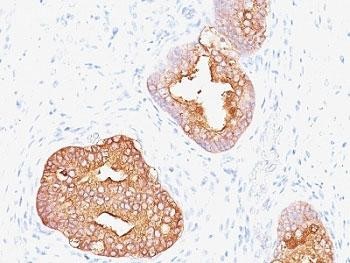 Anti-PSA (Prostate Specific Antigen), clone 1A7 or 1A7G6B6