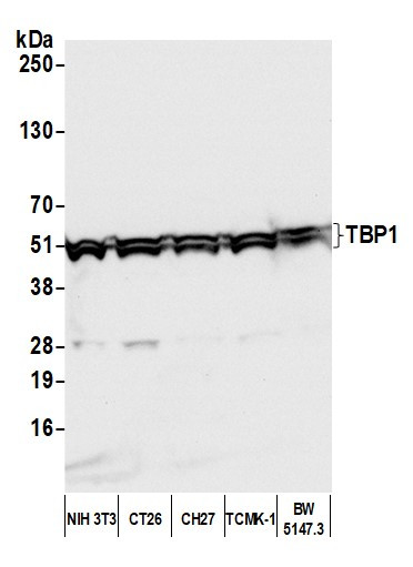 Anti-TBP1