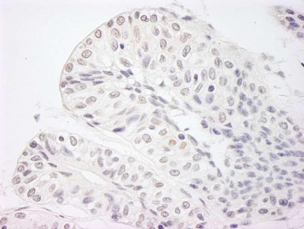 Anti-JARID1A/RBP2 IHC Antibody, affinity purifie (IHC)