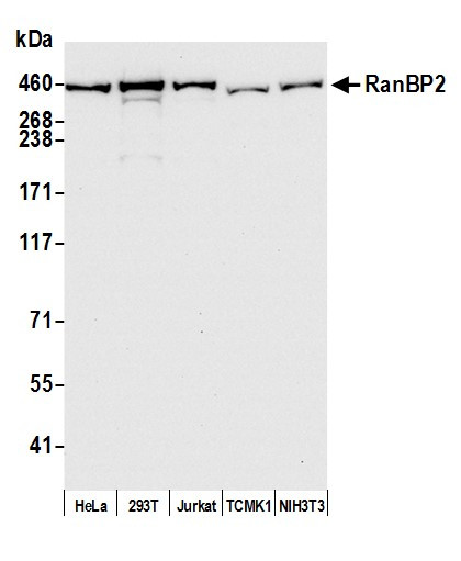 Anti-RanBP2