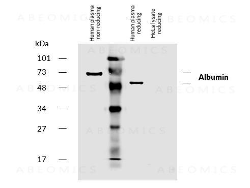 Anti-Albumin Monoclonal Antibody (Clone:AL-01)