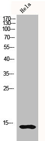 Anti-Histone H2B