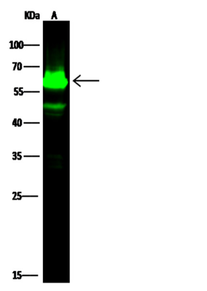 Anti-Cytokeratin 5/KRT5 Monoclonal Recombinant Antibody