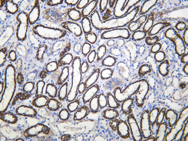 Anti-Recombinant CP27B, clone C112568