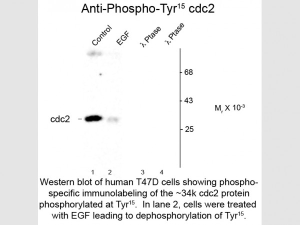 Anti-phospho-cdc2 (Thr15)