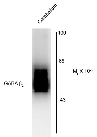 Anti-GABAA Receptor beta 2